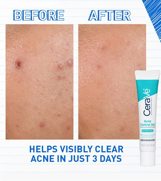 Cerave Blemish Control Gel Moisturiser 40Ml