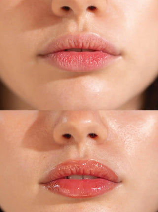 Close-up of a person's lips with a before and after comparison on a blurred background.