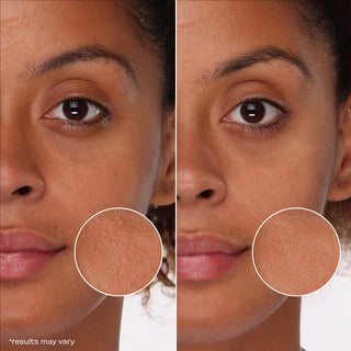 Side-by-side comparison of a woman's face with close-up of skin texture on a white background.