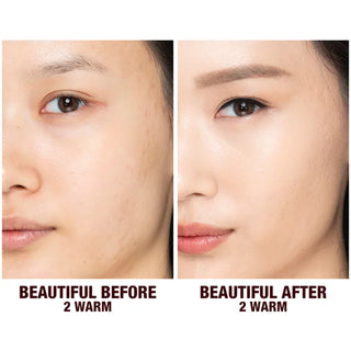 Before and after comparison of a person's face with text indicating 'Beautiful Before 2 Warm' and 'Beautiful After 2 Warm'.