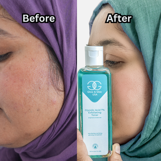 Before and after comparison of a person holding a bottle of 'Glow & Glee USA' skincare product.