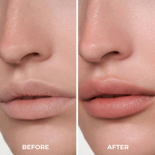 Before and after comparison of lips on a neutral background