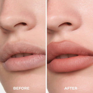 Before and after comparison of lips with 'Before' on the left and 'After' on the right.
