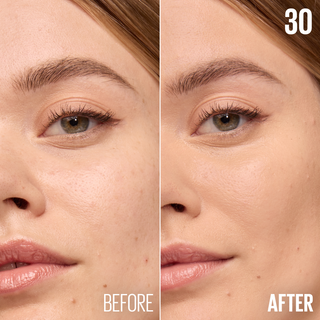 Before and after comparison of a woman's face with 'Prima' and 'Dopo' labels.