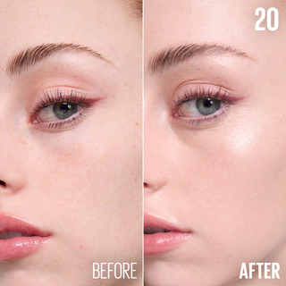 Before and after comparison of a woman's eye area with visible improvement.
