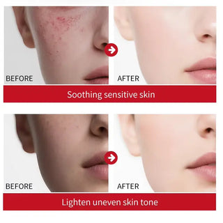 Estelin 5X Ceramide Barrier Repairing Serum 50Ml